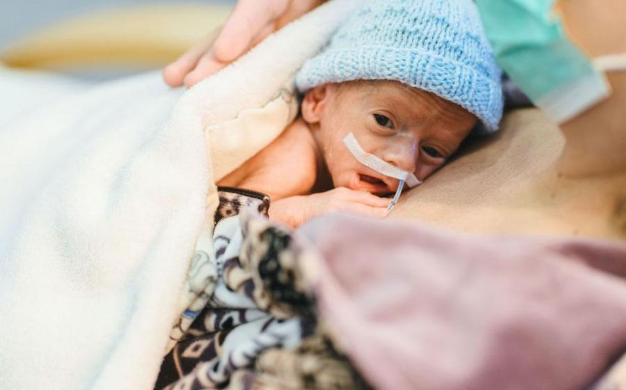What Your Preemie Is Fed Today Impacts Tomorrow's Milestones