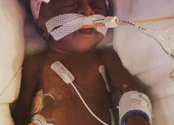The Simple Nutritional Choice That Could Change Your Preemie’s Future 